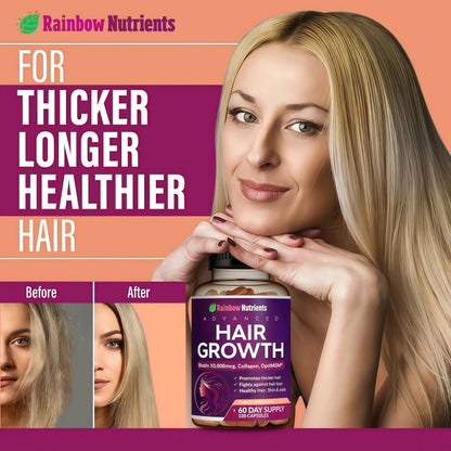 Hair Growth Vitamins for Women | Biotin 10,000mcg, Collagen, Patented OptiMSM®, goMCT®, Saw Palmetto | Naturally Regrow Stronger & Healthier Hair, Skin and Nails | May Stop Hair Loss
